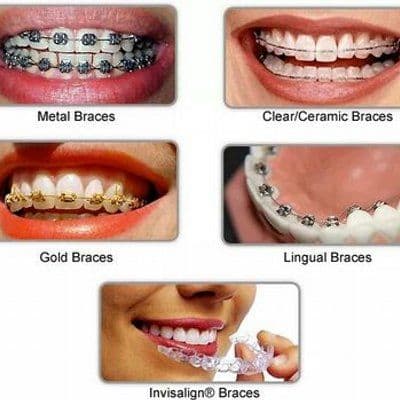 Dr.Mathesul Invisalign Orthodontist Braces Pune color logo
