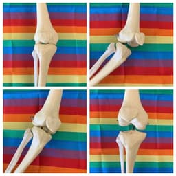 The Knee Joint Powered